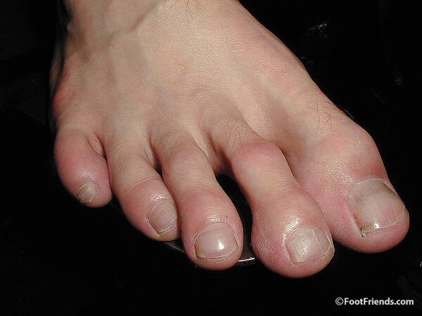 His Long Toes