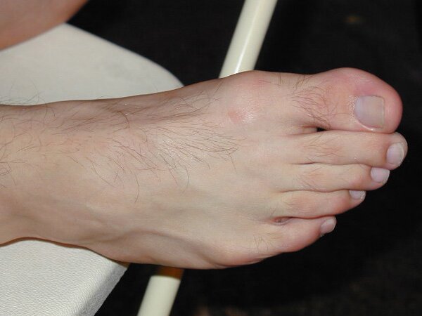 Eric’s slim feet and sheer dark socks steal the show