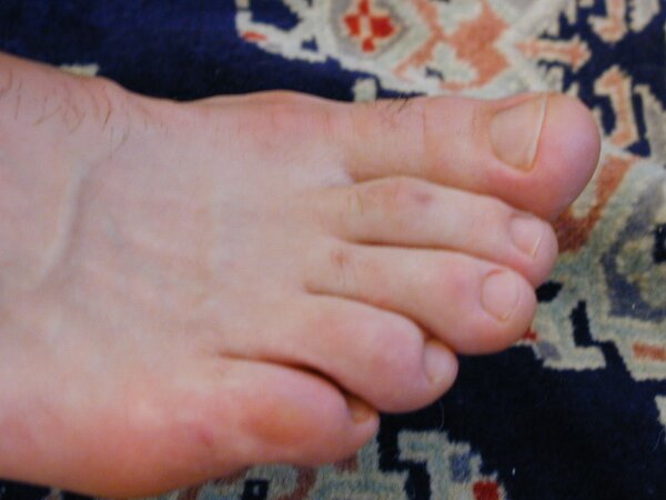 Mr. Pratt tickles Ridgeway’s feet through his sheer socks