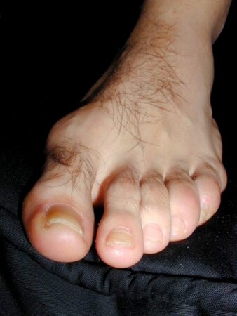 Rich receives golden foot award at My Friend's Feet event