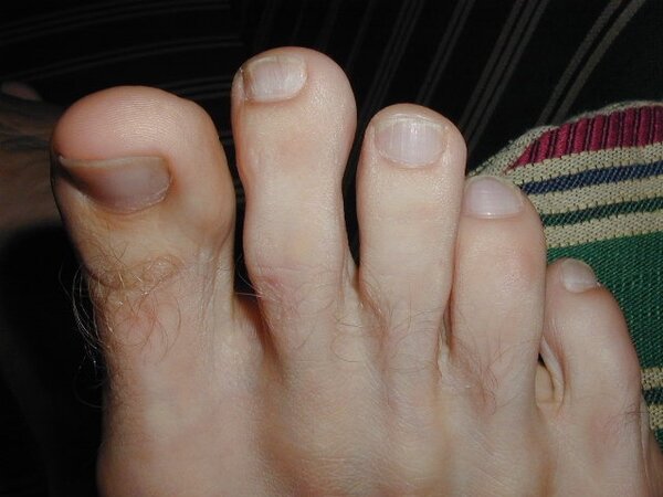 Rich receives golden foot award at My Friend's Feet event