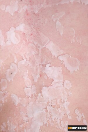 Rent boy Liam King suffers red-hot wax on cock and balls