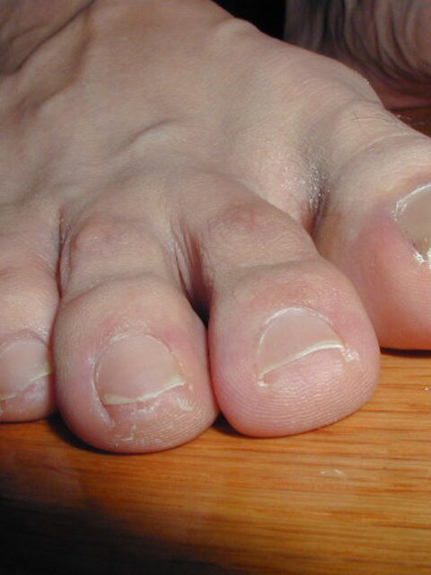 Rodrigo reveals his sweet toes after a run