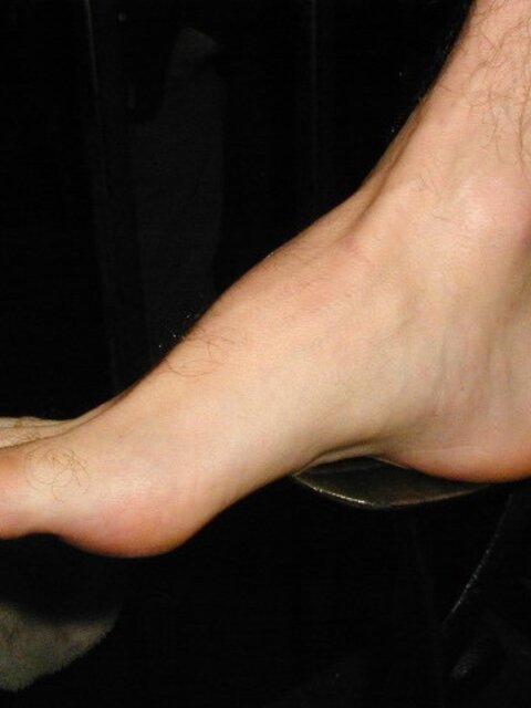 Tommi balances Alan Pratt with his size 14 feet